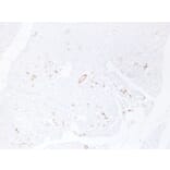 Immunohistochemistry - Anti-Cytokeratin 19 Antibody (V0051) - Antibodies.com