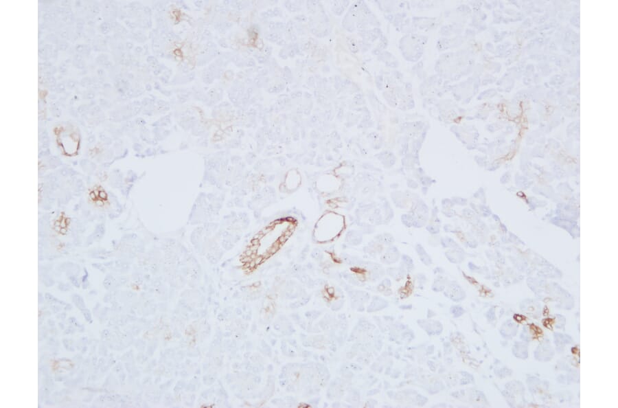 Immunohistochemistry - Anti-Cytokeratin 19 Antibody (V0051) - Antibodies.com