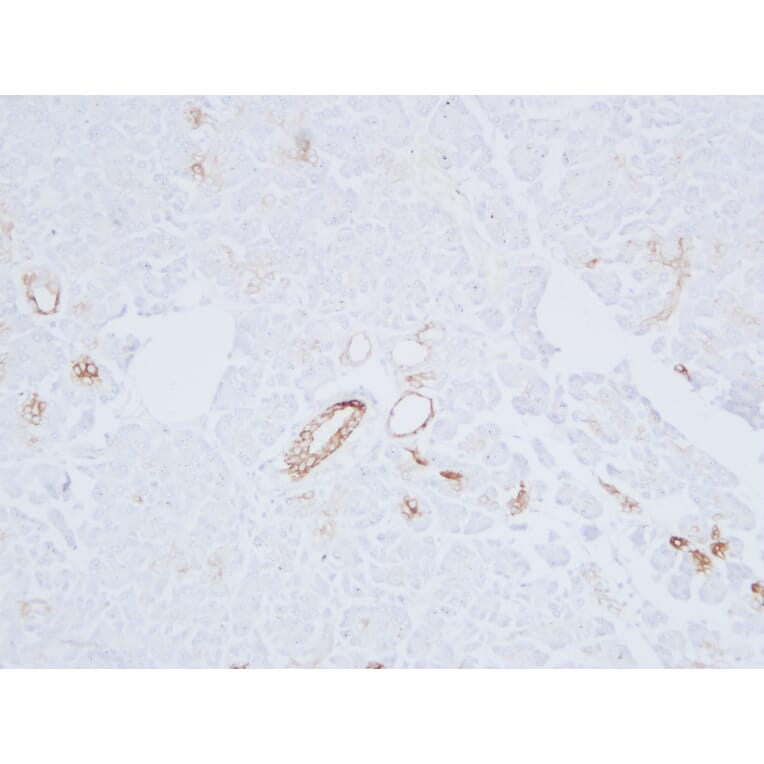 Immunohistochemistry - Anti-Cytokeratin 19 Antibody (V0051) - Antibodies.com