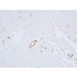 Immunohistochemistry - Anti-Cytokeratin 19 Antibody (V0051) - Antibodies.com