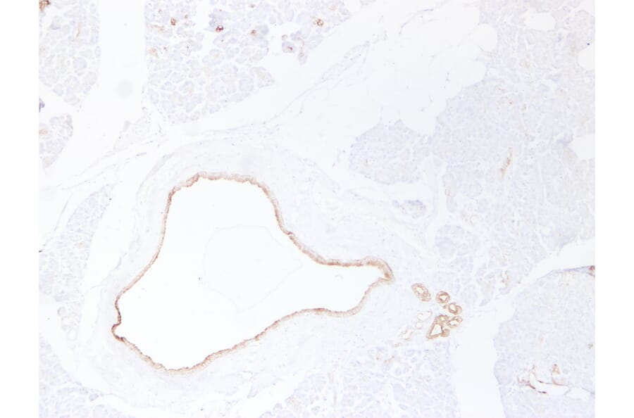 Immunohistochemistry - Anti-Cytokeratin 19 Antibody (V0051) - Antibodies.com