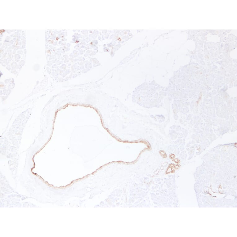 Immunohistochemistry - Anti-Cytokeratin 19 Antibody (V0051) - Antibodies.com