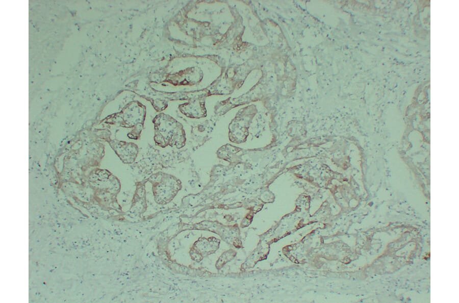 Immunohistochemistry - Anti-Cytokeratin 18 Antibody (V0050) - Antibodies.com