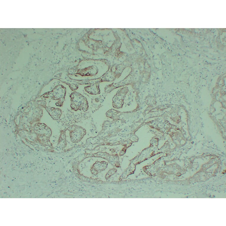 Immunohistochemistry - Anti-Cytokeratin 18 Antibody (V0050) - Antibodies.com