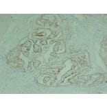 Immunohistochemistry - Anti-Cytokeratin 18 Antibody (V0050) - Antibodies.com