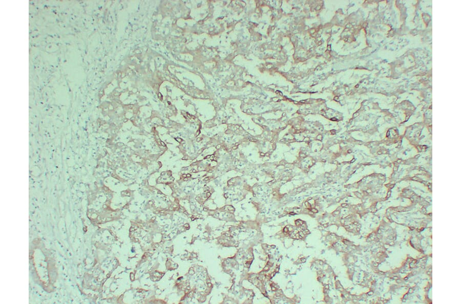 Immunohistochemistry - Anti-Cytokeratin 18 Antibody (V0050) - Antibodies.com
