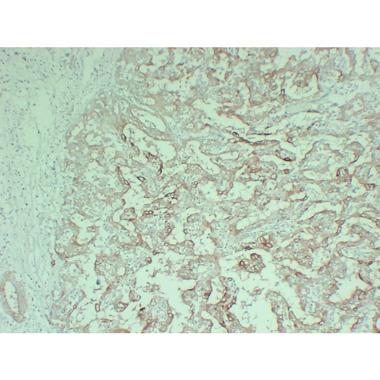 Immunohistochemistry - Anti-Cytokeratin 18 Antibody (V0050) - Antibodies.com