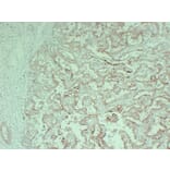 Immunohistochemistry - Anti-Cytokeratin 18 Antibody (V0050) - Antibodies.com