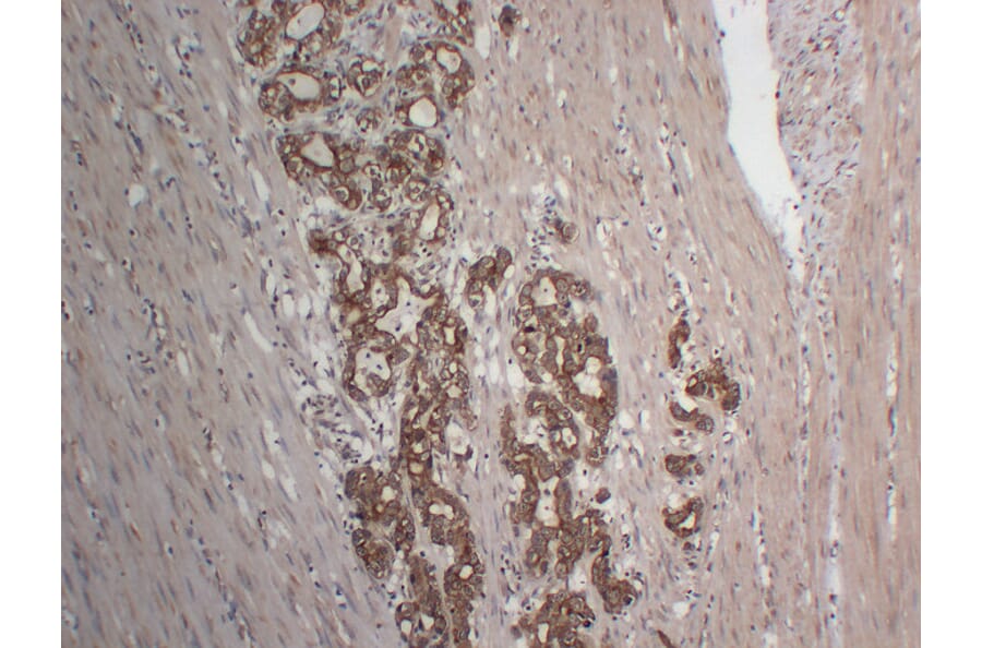 Immunohistochemistry - Anti-Cytokeratin 18 Antibody (V0050) - Antibodies.com