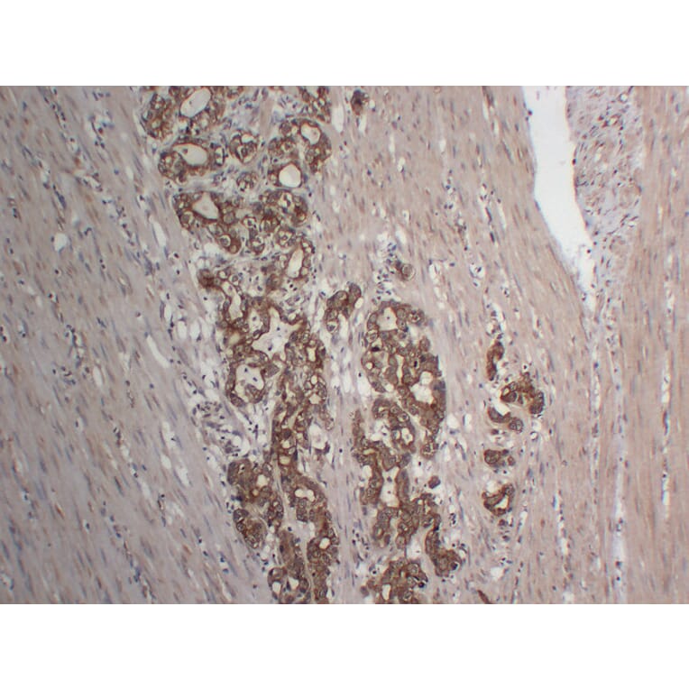 Immunohistochemistry - Anti-Cytokeratin 18 Antibody (V0050) - Antibodies.com