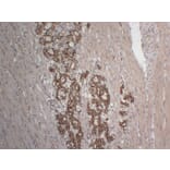 Immunohistochemistry - Anti-Cytokeratin 18 Antibody (V0050) - Antibodies.com