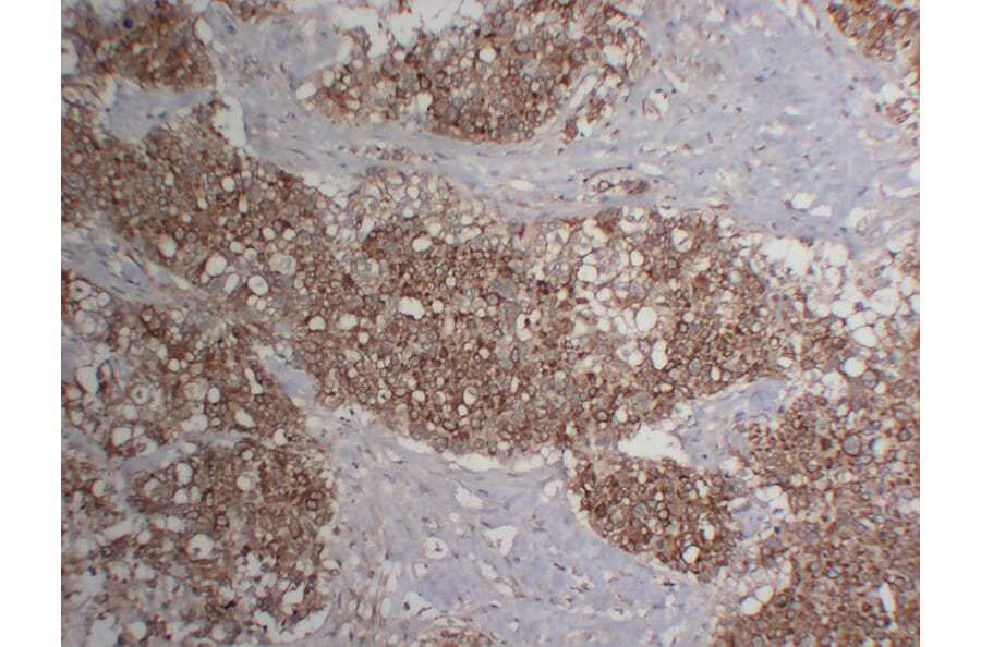 Immunohistochemistry - Anti-Cytokeratin 18 Antibody (V0050) - Antibodies.com