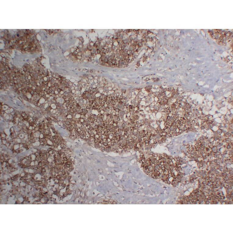 Immunohistochemistry - Anti-Cytokeratin 18 Antibody (V0050) - Antibodies.com