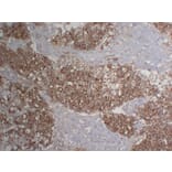 Immunohistochemistry - Anti-Cytokeratin 18 Antibody (V0050) - Antibodies.com