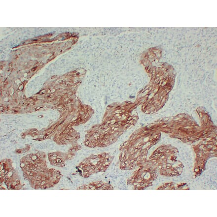 Immunohistochemistry - Anti-Cytokeratin 17 Antibody (V0049) - Antibodies.com