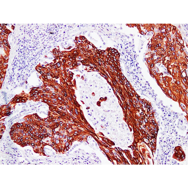 Immunohistochemistry - Anti-Cytokeratin 17 Antibody (V0049) - Antibodies.com