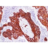 Immunohistochemistry - Anti-Cytokeratin 17 Antibody (V0049) - Antibodies.com