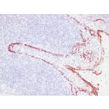 Immunohistochemistry - Anti-Cytokeratin 17 Antibody (V0049) - Antibodies.com