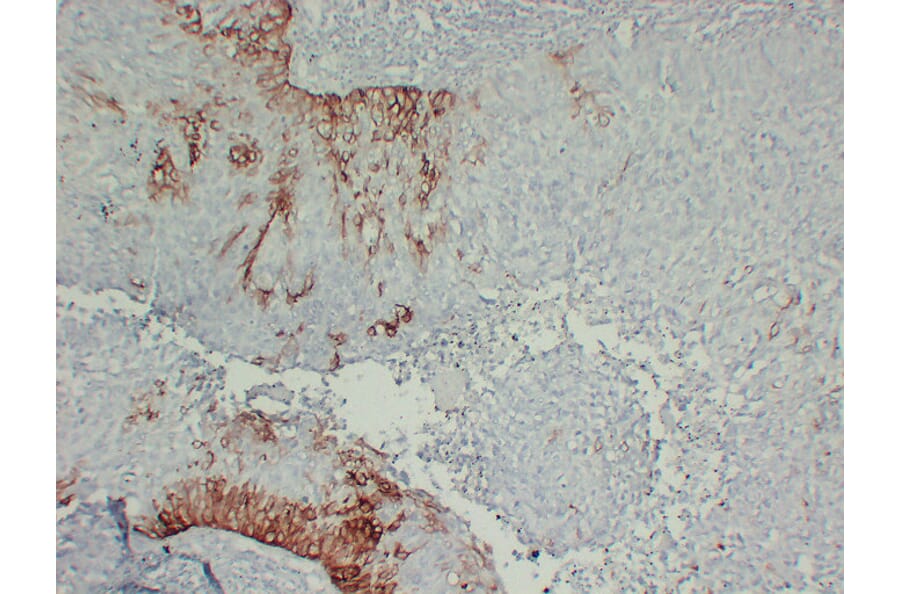 Immunohistochemistry - Anti-Cytokeratin 15 Antibody (V0047) - Antibodies.com