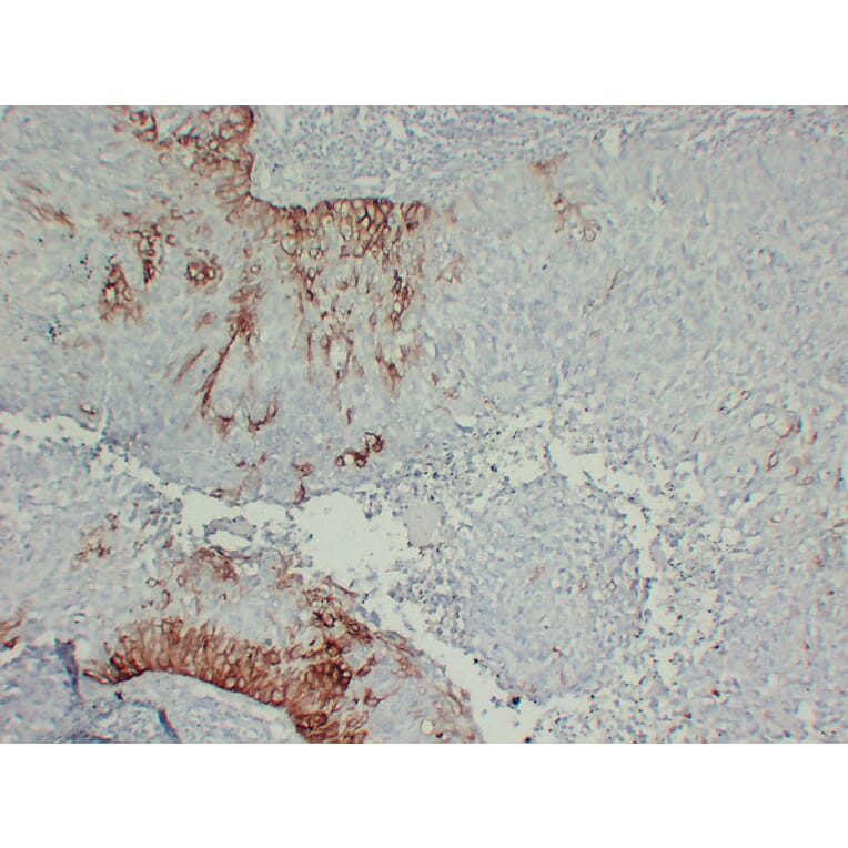 Immunohistochemistry - Anti-Cytokeratin 15 Antibody (V0047) - Antibodies.com