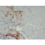 Immunohistochemistry - Anti-Cytokeratin 15 Antibody (V0047) - Antibodies.com