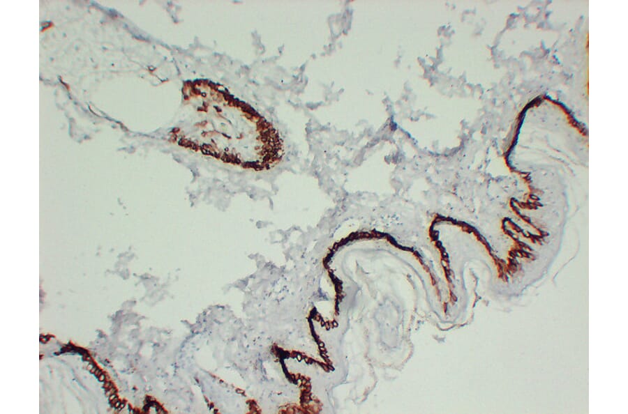 Immunohistochemistry - Anti-Cytokeratin 15 Antibody (V0047) - Antibodies.com