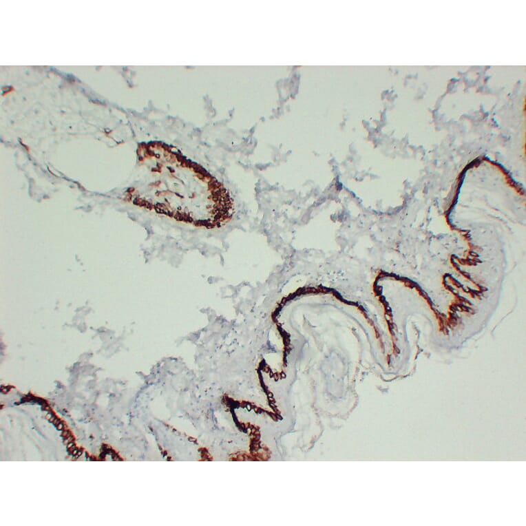 Immunohistochemistry - Anti-Cytokeratin 15 Antibody (V0047) - Antibodies.com