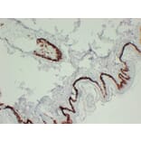 Immunohistochemistry - Anti-Cytokeratin 15 Antibody (V0047) - Antibodies.com