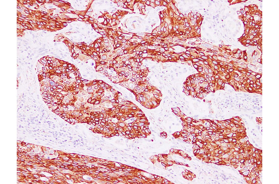 Immunohistochemistry - Anti-Cytokeratin 15 Antibody (V0047) - Antibodies.com