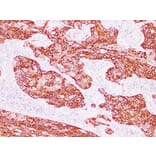 Immunohistochemistry - Anti-Cytokeratin 15 Antibody (V0047) - Antibodies.com