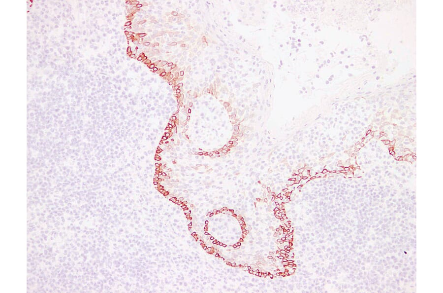 Immunohistochemistry - Anti-Cytokeratin 15 Antibody (V0047) - Antibodies.com