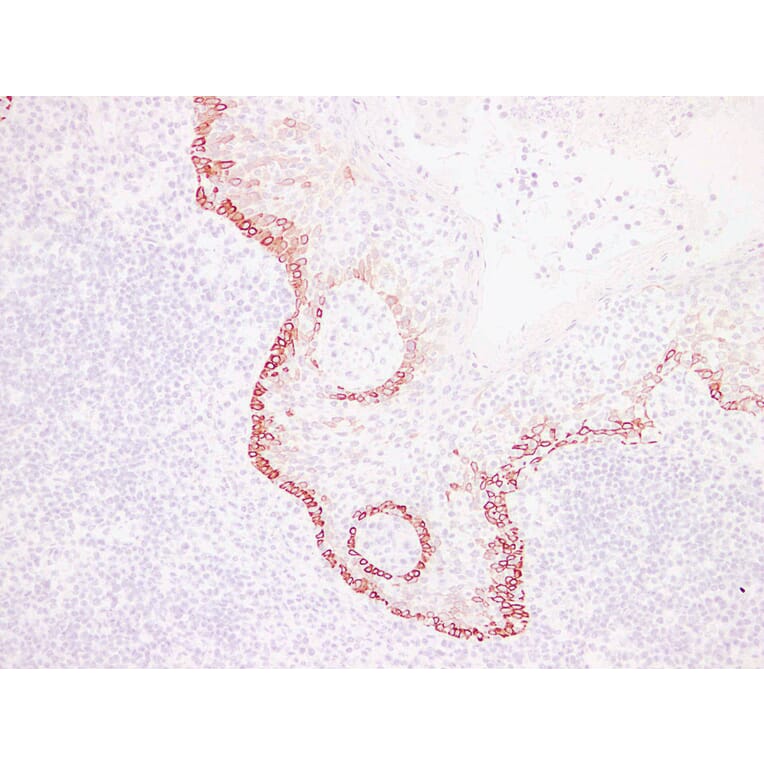 Immunohistochemistry - Anti-Cytokeratin 15 Antibody (V0047) - Antibodies.com