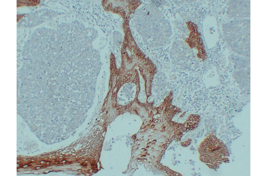 Immunohistochemistry - Anti-Cytokeratin 14 Antibody (V0046) - Antibodies.com