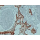 Immunohistochemistry - Anti-Cytokeratin 14 Antibody (V0046) - Antibodies.com