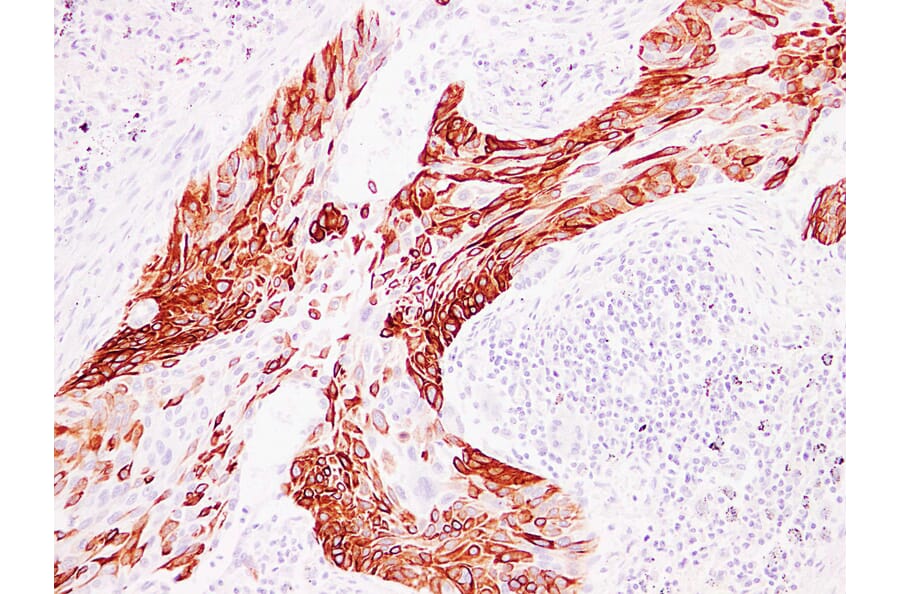 Immunohistochemistry - Anti-Cytokeratin 14 Antibody (V0046) - Antibodies.com