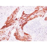 Immunohistochemistry - Anti-Cytokeratin 14 Antibody (V0046) - Antibodies.com