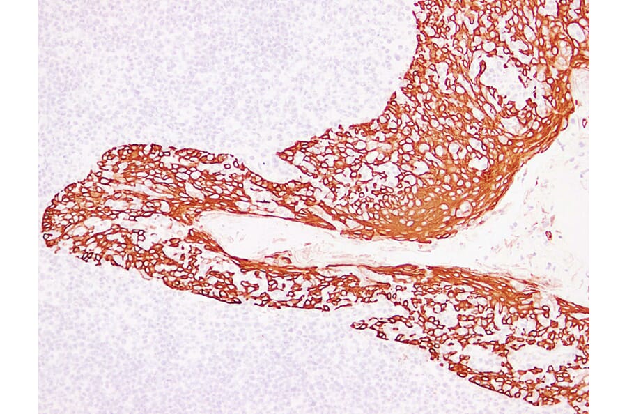 Immunohistochemistry - Anti-Cytokeratin 14 Antibody (V0046) - Antibodies.com