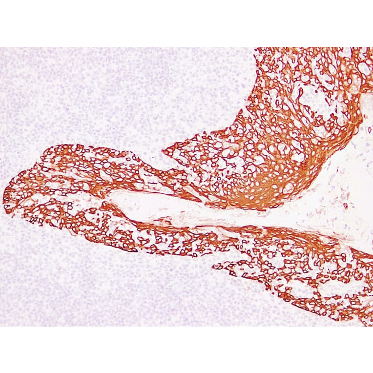 Immunohistochemistry - Anti-Cytokeratin 14 Antibody (V0046) - Antibodies.com