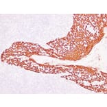 Immunohistochemistry - Anti-Cytokeratin 14 Antibody (V0046) - Antibodies.com