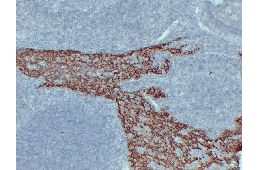 Immunohistochemistry - Anti-Cytokeratin 14 Antibody (V0046) - Antibodies.com