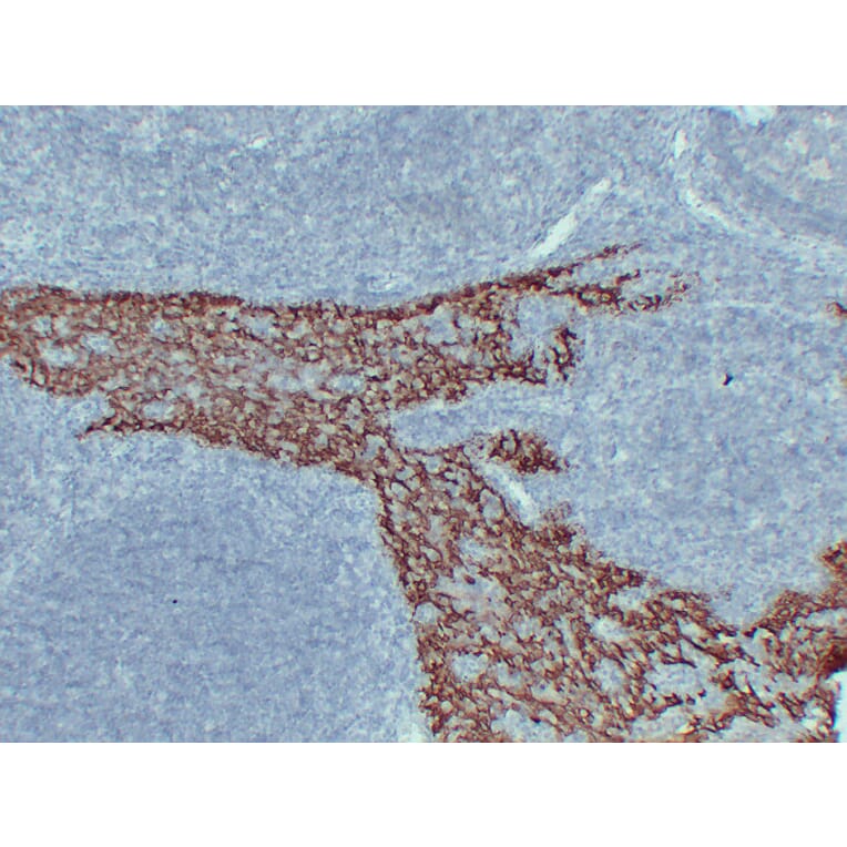 Immunohistochemistry - Anti-Cytokeratin 14 Antibody (V0046) - Antibodies.com