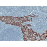 Immunohistochemistry - Anti-Cytokeratin 14 Antibody (V0046) - Antibodies.com