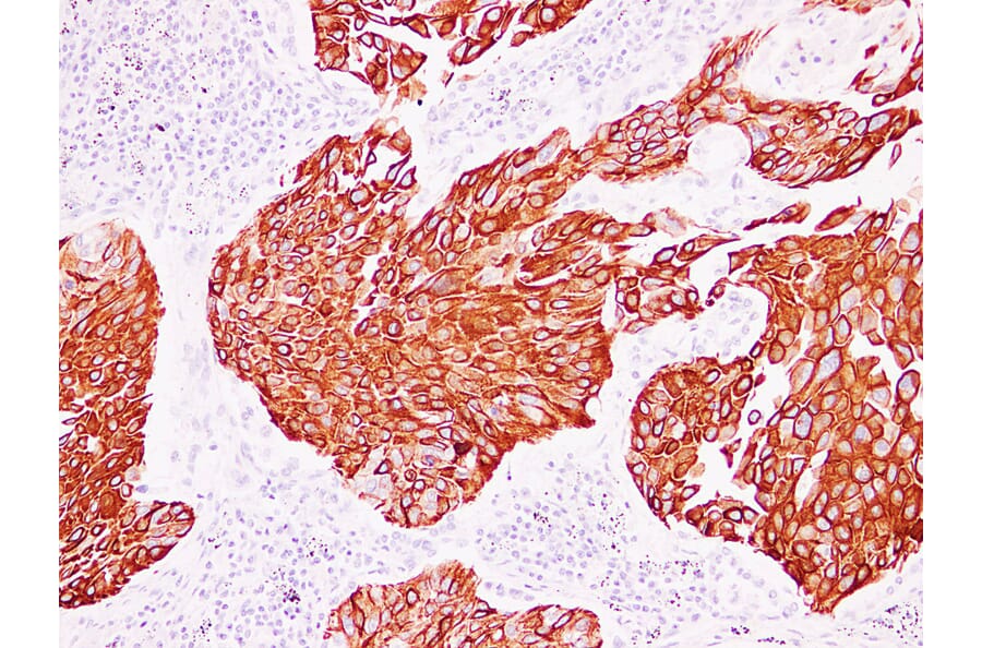 Immunohistochemistry - Anti-Cytokeratin 13 Antibody (V0045) - Antibodies.com