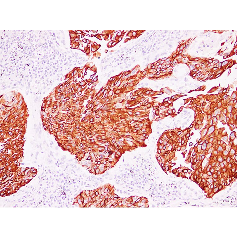 Immunohistochemistry - Anti-Cytokeratin 13 Antibody (V0045) - Antibodies.com