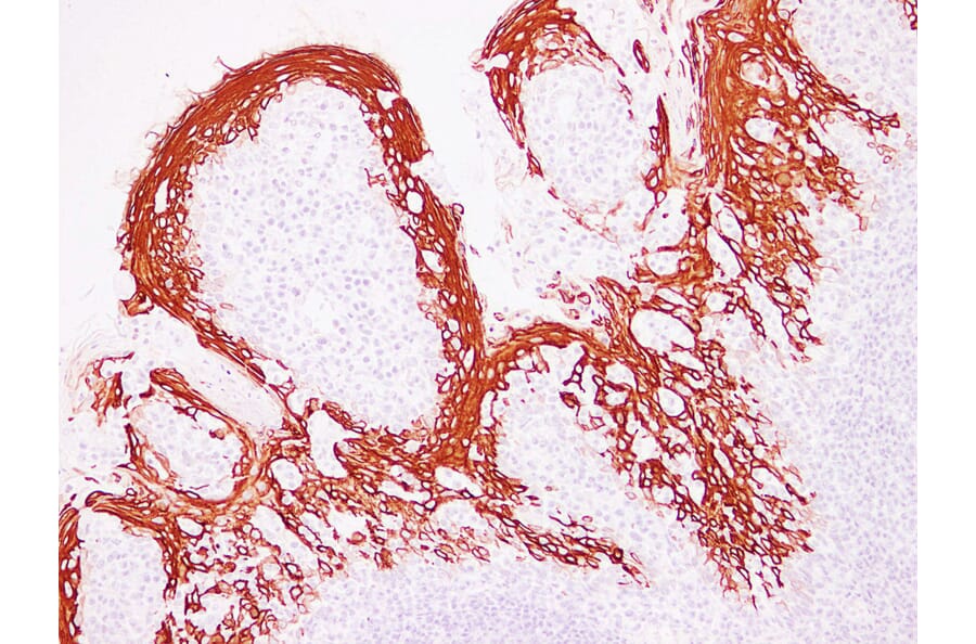 Immunohistochemistry - Anti-Cytokeratin 13 Antibody (V0045) - Antibodies.com