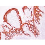 Immunohistochemistry - Anti-Cytokeratin 13 Antibody (V0045) - Antibodies.com