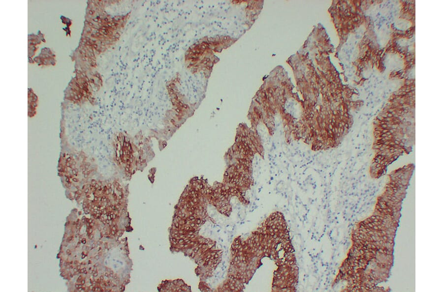 Immunohistochemistry - Anti-Cytokeratin 13 Antibody (V0045) - Antibodies.com