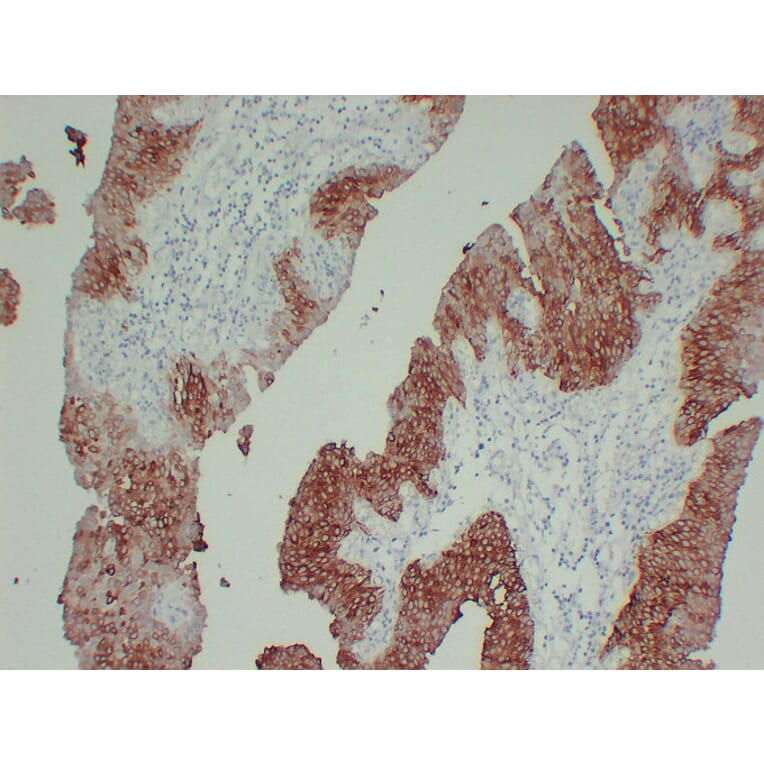 Immunohistochemistry - Anti-Cytokeratin 13 Antibody (V0045) - Antibodies.com