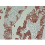 Immunohistochemistry - Anti-Cytokeratin 13 Antibody (V0045) - Antibodies.com