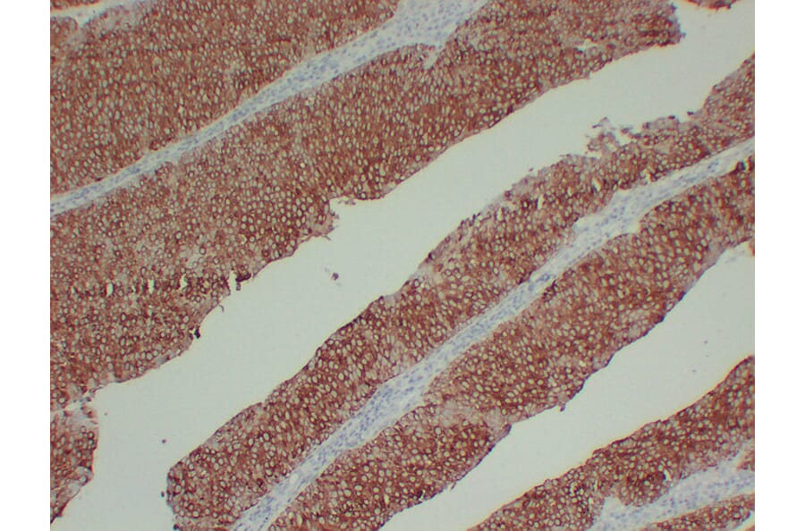 Immunohistochemistry - Anti-Cytokeratin 13 Antibody (V0045) - Antibodies.com